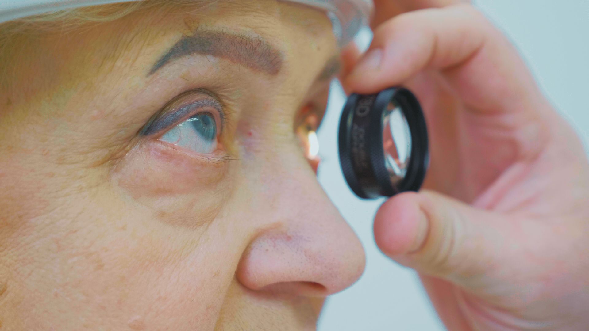 Когда после замены хрусталика восстанавливается зрение глаза. Глазные болезни: глаукома, катаракта. Анатомия глаза катаракта. Глаза больных глаукомой. Упражнения для глаз при катаракте.